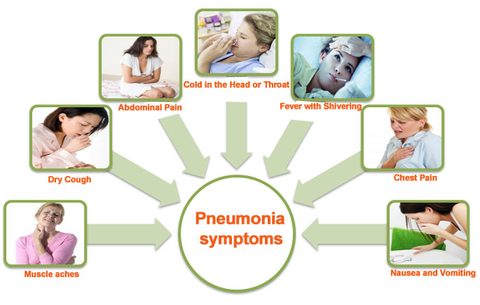 Top 14 Natural Home Remedies For Pneumonia Symptoms